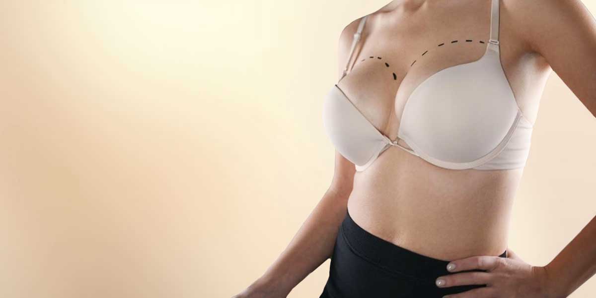 Breast Augmentation in Delhi